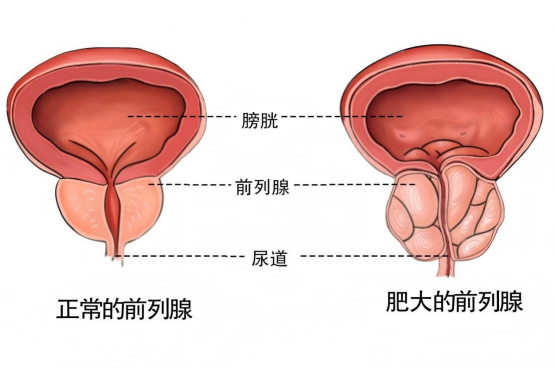 from clipboard from clipboard